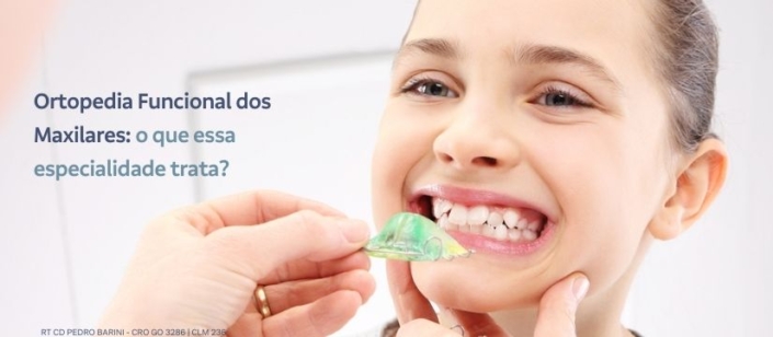 Conheça a ortopedia funcional dos maxilares e entenda como funciona esta especialidade da odontologia. Conheça esta e muito mais na Barini Odontologia;