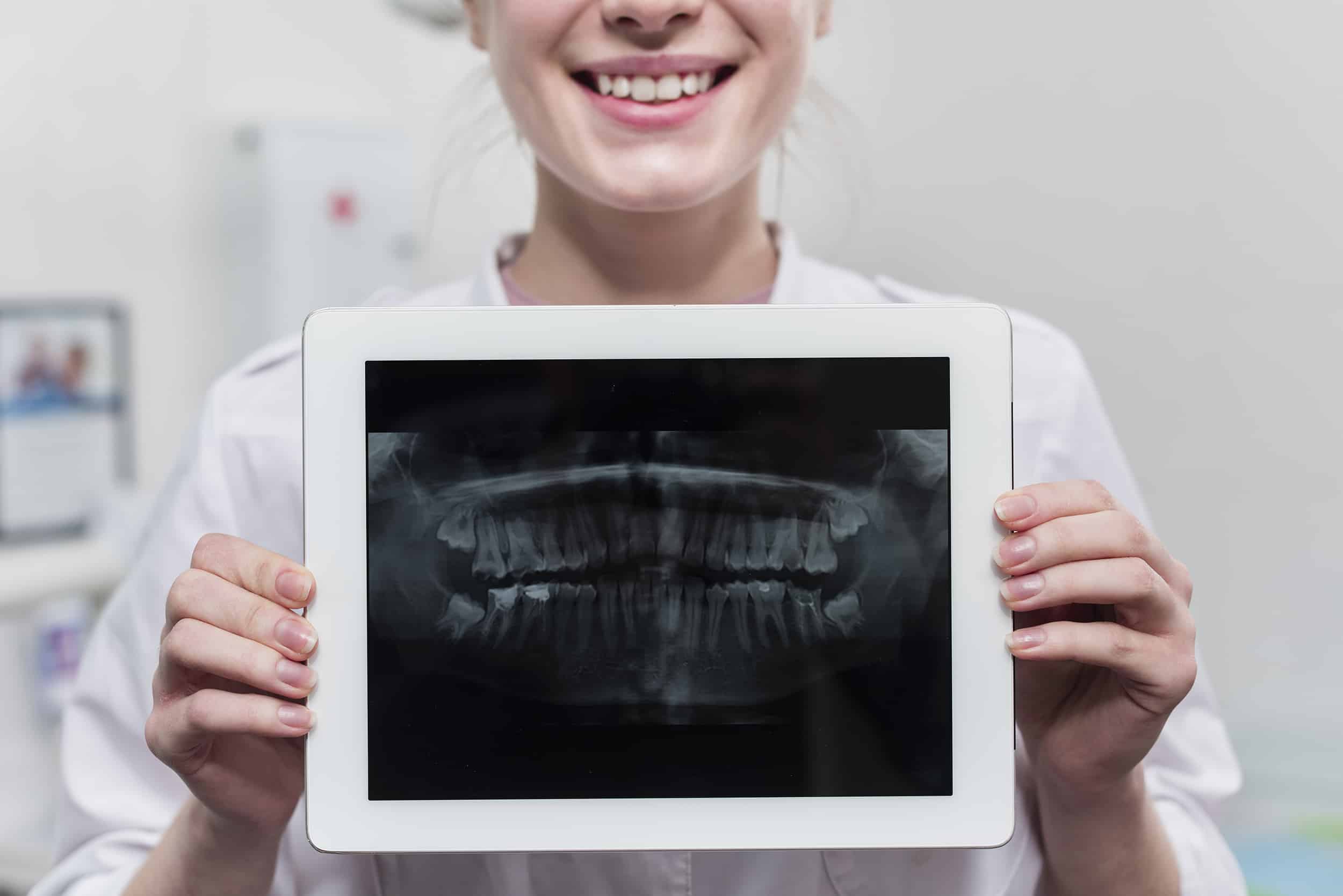 close up woman holding teeth x ray