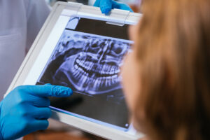 Mãos de um dentista usando luvas azuis mostrando uma radiografia panorâmica em um tablet para uma paciente.